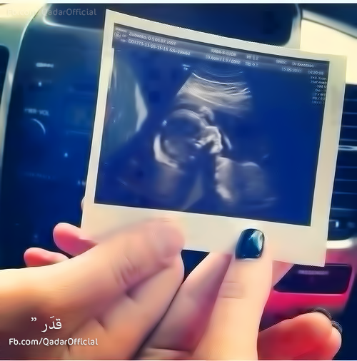 ruu___1's tweet photo. عن اليوم ده *.* http://t.co/z3hYdRIo4Z