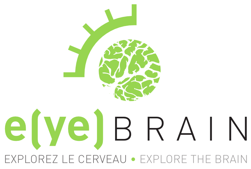 ALA_Group's tweet photo. #Crowdfunding : #EyeBrain lève 1,3 million d’euros avec Anaxago http://t.co/peu1WbRSm0 @eye_brain http://t.co/oOG9L24GgC