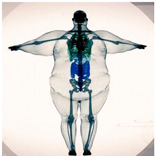 NewEra_Trends's tweet image. If You Are Into Working Out, THIS Is Your Next Big Purchase 👉 neorea.ch/1yE88VQ