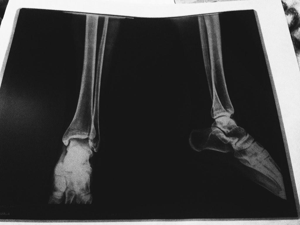 cindy_rebeca's tweet image. #partsofme