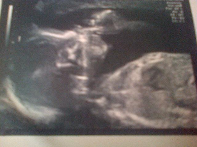 My baby girl due in june xx