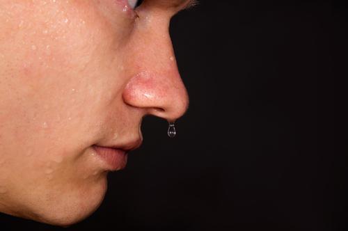DrReisfeld's tweet photo. Why is #facialblushing #facialsweating treatment a controversial subject? Our honest answer: http://t.co/5Wai0Fo5v7 http://t.co/CFqYPMtNq6