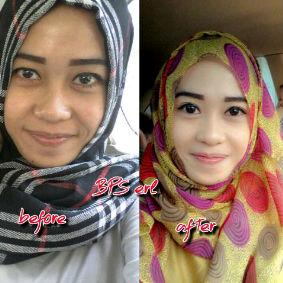 ecaDew's tweet photo. Kulit kusam n berjerawat?  BPS Erl solusi instan dan terjangkau. 
Pemesanan via sms/line:  081907772454 pin 7ccca153 http://t.co/XA0RXMupZ3