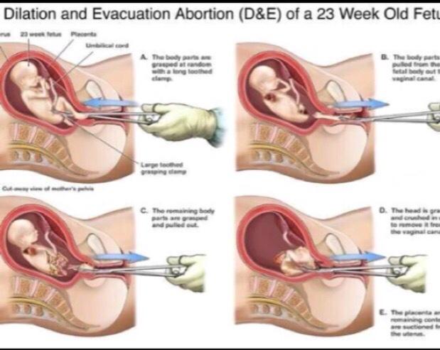 Lamp1939's tweet image. “@DrMartyFox: So, Who Says Abortion Isn't Murder? @mimimayesTN @ChuckCJohnson http://t.co/mXNqKMctdR”Dems against Torture are OK with THIS