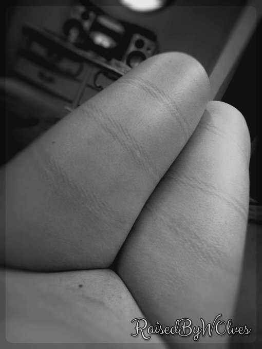 I 💖 the way the #rope leaves #marks on my skin. 😘 #ropework #bondage #aftercare http://t.co/Dtjk1fwA<a href="/tag/rope"class="tags">#rope</a><a href="/tag/marks"class="tags">#marks</a><a href="/tag/bondage"class="tags"><span>#bondage</span></a><a href="/tag/aftercare"class="tags"><span>#aftercare</span></a><a href="/tag/ropework"class="tags"><span>#ropework</span></a>