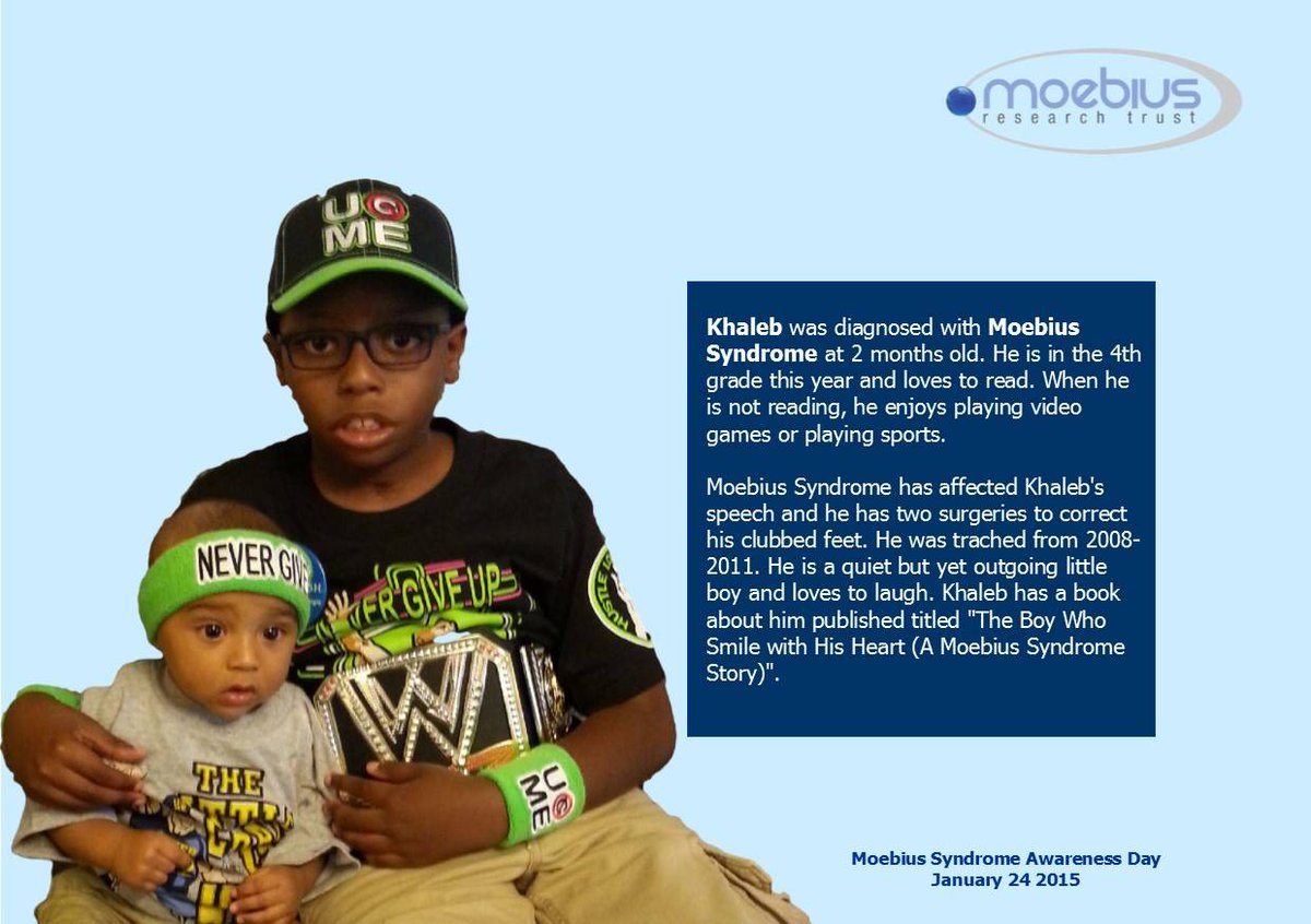 JRJPartridge's tweet photo. RT @FaceEquality: We're proud to mark Moebius Syndrome Awareness Day #MSAD15 with our friends at @MoebiusUK. http://t.co/Qo94deZ12q