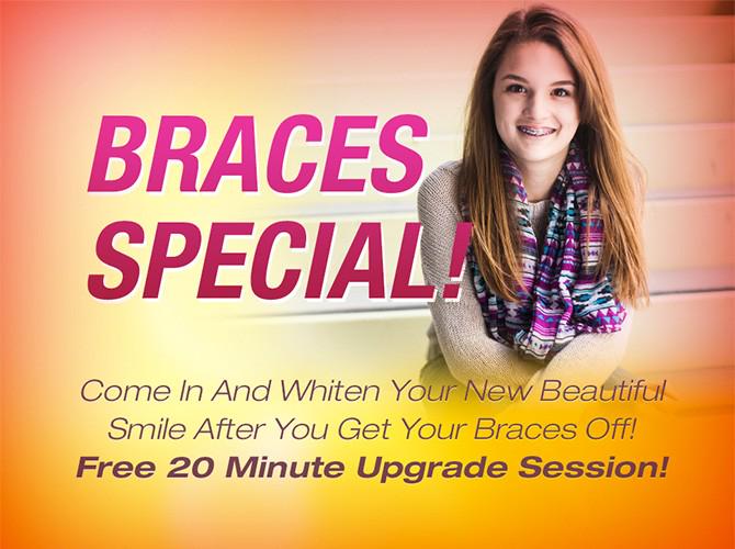 YOU DESERVE IT!  When the big day comes make sure you call us to schedule your teeth whitening!