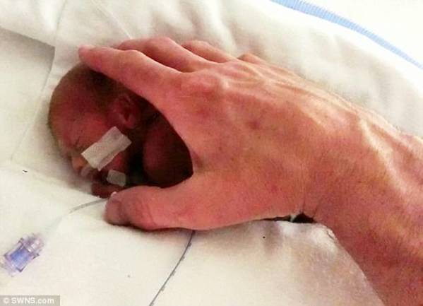 HottestViral's tweet photo. He Was Born So Early, No One Thought He'd Survive..But Then Something Shocking Happened. http://t.co/C2nuJCeVz6 http://t.co/cy2CbeXDUE