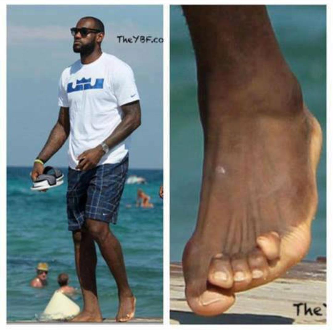 troytheblackguy's tweet photo. This nigga Lebron toes fighting for a spot on his foot lmao http://t.co/fmKRs1NugV