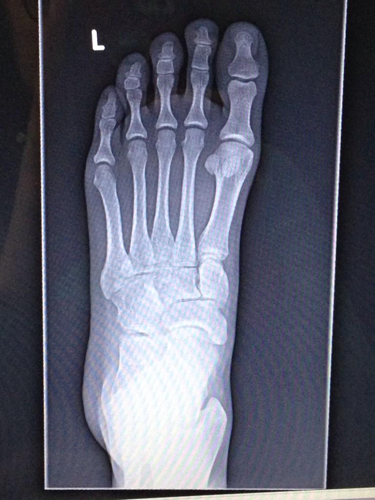 mrsbeatysclass's tweet image. Can't wait to show my kids my bones! They are going to love this! Haha! #longbones #notbroken yay!!