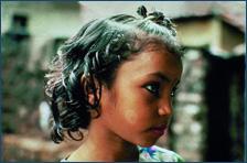 UsizeAfrica's tweet image. Yesterday was World Leprosy Day - a disease is still surrounded by stigma. #aidanddevelopment