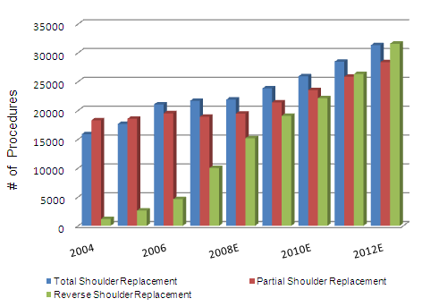 theshoulder's tweet photo. Shoulders are the third most commonly replaced joints in US. http://t.co/JZoTbCHhPk #shoulder #Fracture #bones http://t.co/CesuIGiH8z