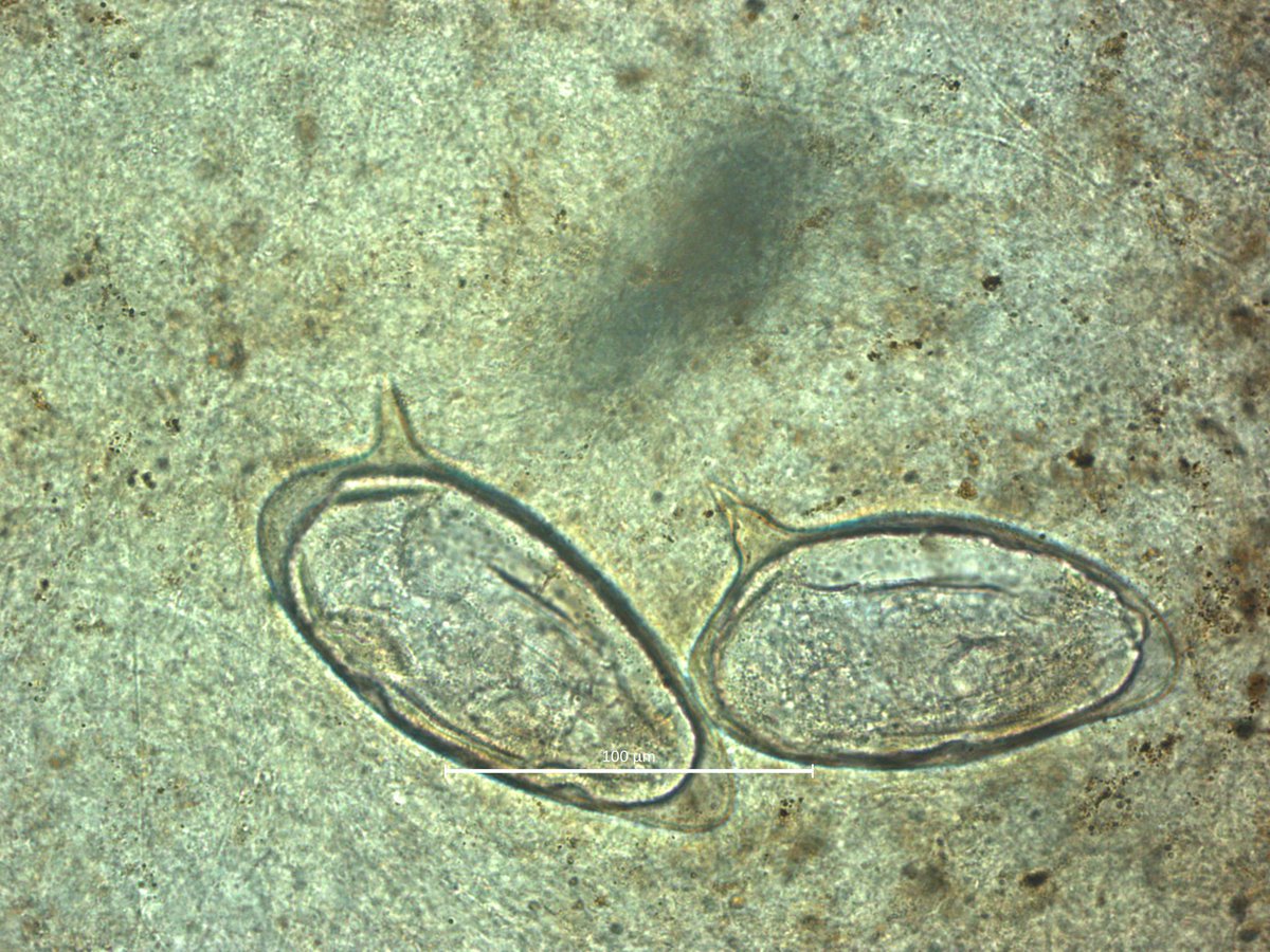 PARAENVI's tweet photo. Beautiful S. mansoni eggs 40x #parworld #schistosomiasis #ucph http://t.co/2mm8ScTwqK