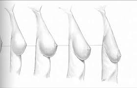 Gidi_Traffic's tweet photo. "@TheProLogic1: #Breastsagging
Smoking reduces d amount of collagen in d skin &makes d skin become weaker&age faster http://t.co/aWKGCZDpw0