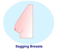 Gidi_Traffic's tweet photo. "@TheProLogic1: #Breastsagging
Sun’s UV rays can damage the #skin, making the #cleavage wrinkle and age prematurely
http://t.co/UddkwPO7ET