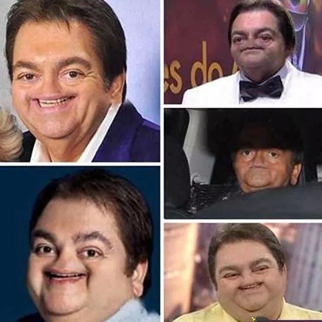 Resultado de imagem para faustão sem nariz