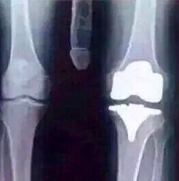 quederap's tweet photo. Cada vez tengo la rodilla peor. http://t.co/0asrzWve6o