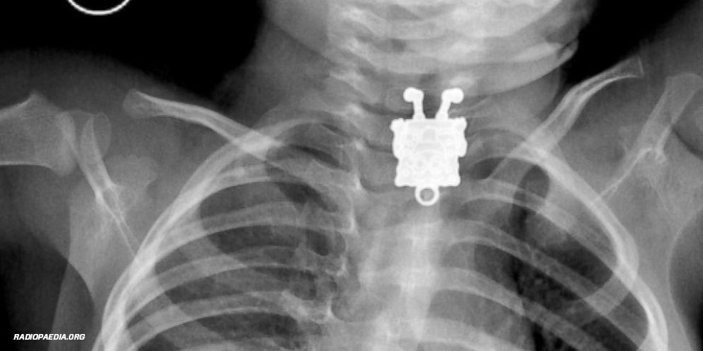 GMA's tweet photo. X-ray shows that SpongeBob SquarePants did not actually live "in a pineapple under the sea." http://t.co/9BzMEJDsry http://t.co/iKYfajDqcj
