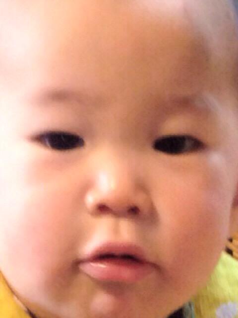 髪の毛生えない