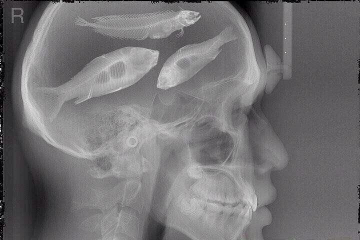 JacobB_18's tweet photo. “@OutdoorObsessor: X-Ray of my brain http://t.co/iNNtKemzVf” @Joshcole27