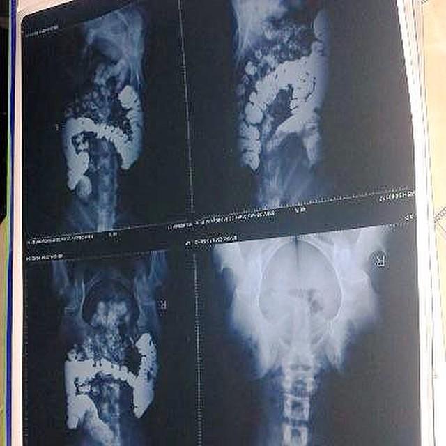 Buat kak rica cepat sembuh ya kak.
Jangan menyerah, allah tidak suka orang yg pantang menyerah loh. <a href="/ricaJKT48/">rica leyona</a>