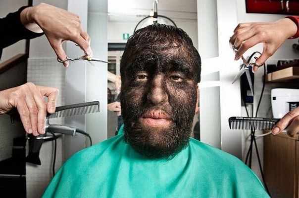 Embedded image permalink