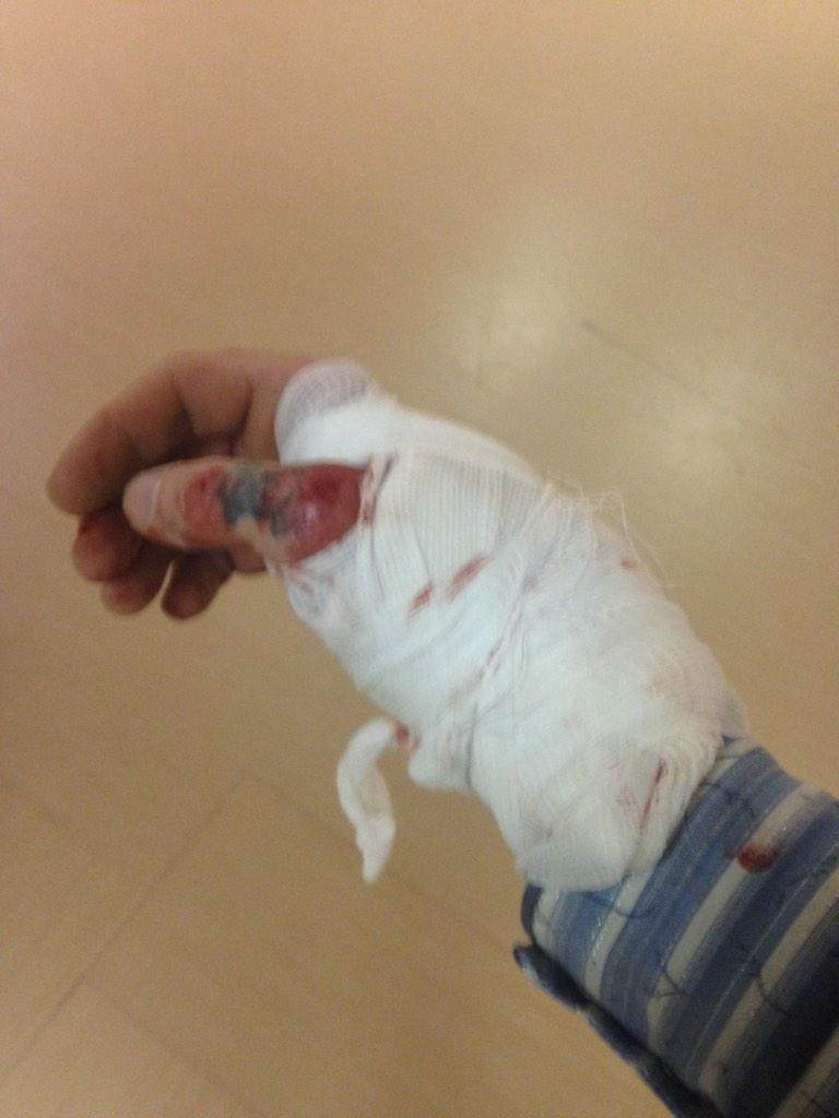 JakeJasper1's tweet photo. Wasn't the best last night could have went in baffled how I did that but I trust in God and will ride next time http://t.co/HL0vq1wqwm