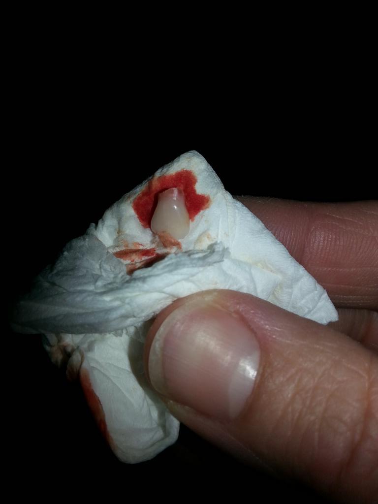 butterfly40_'s tweet photo. No end to my mothering skills #anothertoothpulled http://t.co/D2hzdidscD