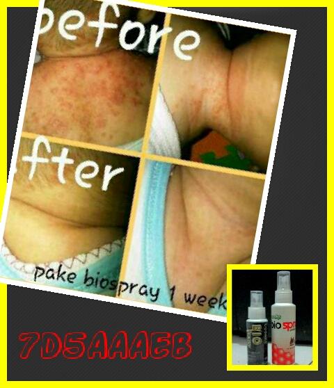 Vimala BioSprayGOLD tweet media