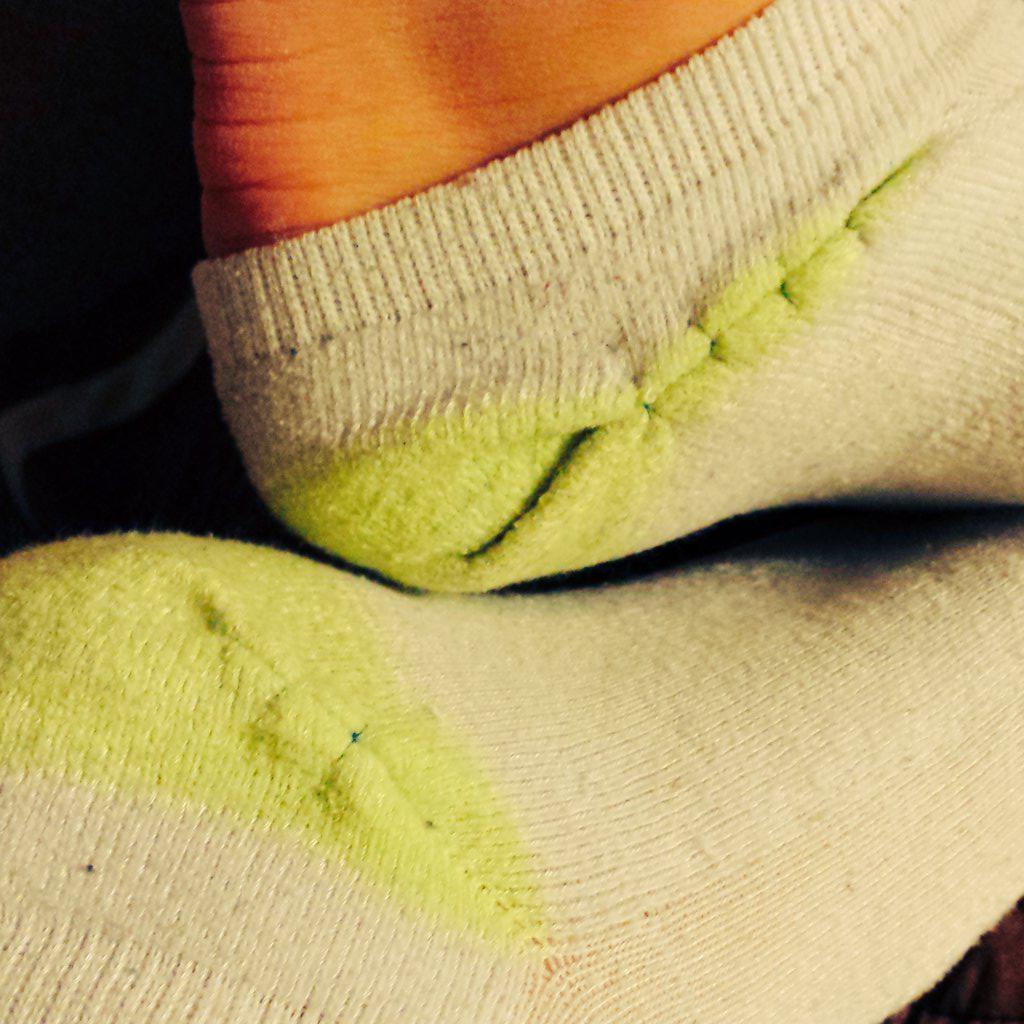 AHopefulDoc's tweet image. Nanners, oranges, socks--where's your surgery stomping ground?