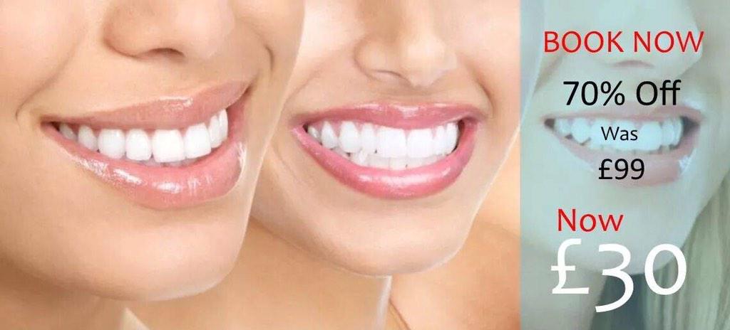 Visit our online store suresmilesgroup.com/store/ to purchase one of our fab whitening kits :)