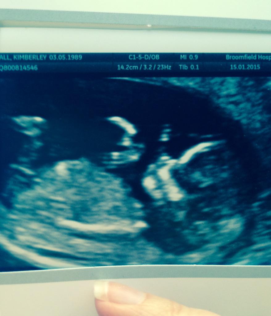 Kimberley Hall tweet media