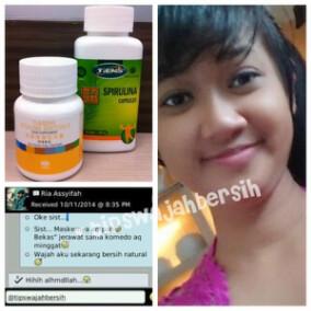 Marwan_Herbal's tweet image. @SCTV_ mau ptih wjah? Atau sluruh bdan? Bsa bgt kok? Vitaline &amp;amp; Spirulina. Mau? WA 082240766320/ 2B686C33