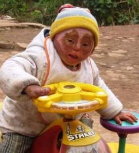 ReecesRainbow's tweet photo. RT Van Trease needs just $3800 to be fully funded!  Please share and give for Keegan today!  http://t.co/KBKk8bfDuJ http://t.co/nb5aECqsBT