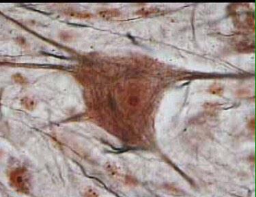 NeuroFUNJC's tweet image. "@CaroHerrera93: @NeuroFUNJC #neuro3 #celulaestrellada #cortezacerebral http://t.co/kbpYNiL8kS" cual es la diferencia con las del cerebelo?