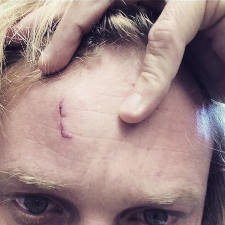 Dit was wild. Dit was rof. Dit was epic! #PretoriaFokJa "<a href="/FrancoisVanCoke/">Francois van Coke</a>: Nog 'n live music battle scar. "