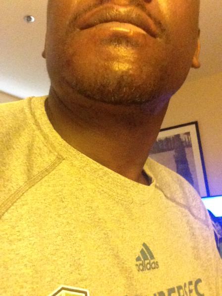 EzraHendrickson's tweet photo. No I didn't put on weight... #wokeupswollen #damntooth #dentistASAP http://t.co/2X2NARCdll