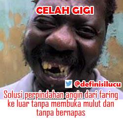 definisilucu's tweet photo. #memelucu #definisilucu celah gigi adlh solusi prpindahn angin dr dalam keluar tanpa membuka mulut dan tanpa bernafas http://t.co/4X9l1Lzw0n