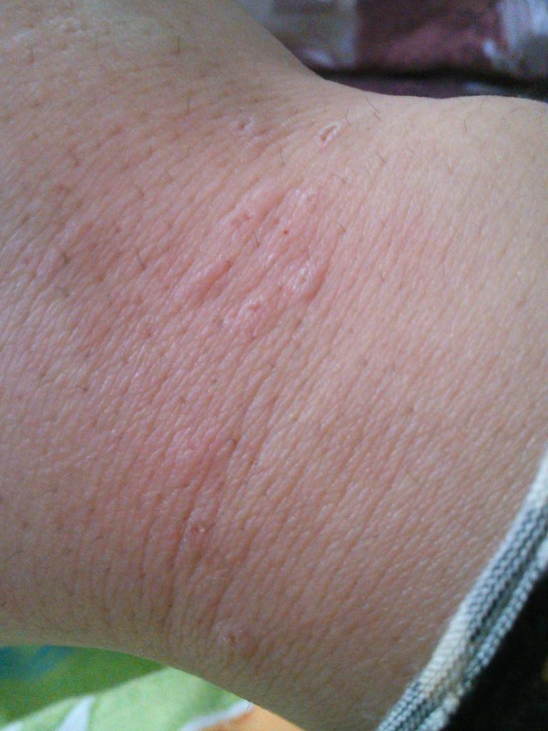 ট ইট র Yamagonn やまごん 友達からline が入って 放鳥中のユキちゃんを構わないでいたら スマホの画面端にオシッコした しかも 文字入力で動いてる右手首をカミカミ 引張りだして たくさんのミミズバレのような 赤い斑点が 文鳥 Http T Co Lm6qojl1bs