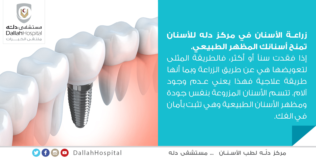 مـسـتـشفيات دلـه Dallah Hospitals Ar Twitter زراعة الأسنان في مركز دله للاسنان نمنح أسنانك المظهر الطبيعي تغريدة معلومة خدمات صحة ابتسامة Http T Co Cfgd2eg3db