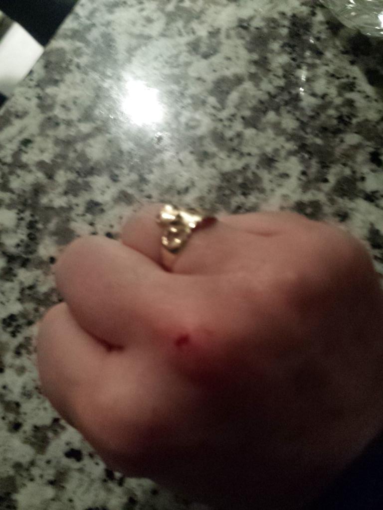 Michellecm86's tweet photo. @MrJerryMcCabe &amp;I just became blood sisters #RockPaperScissors #youshouldseetheotherguy @MiraMomeni @pandorarecords http://t.co/COOOsTA7BF