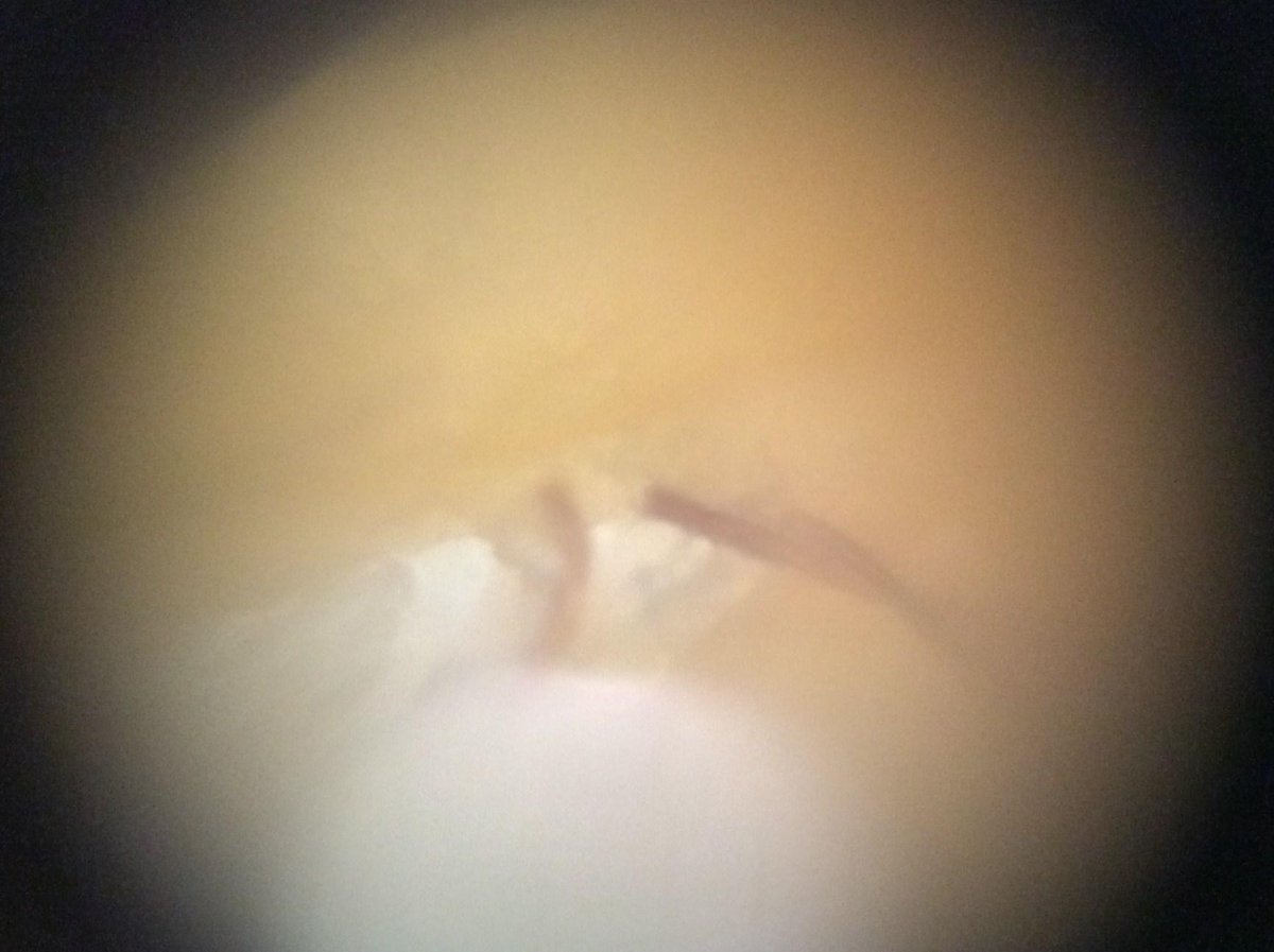 FoldscopeATX tweet picture