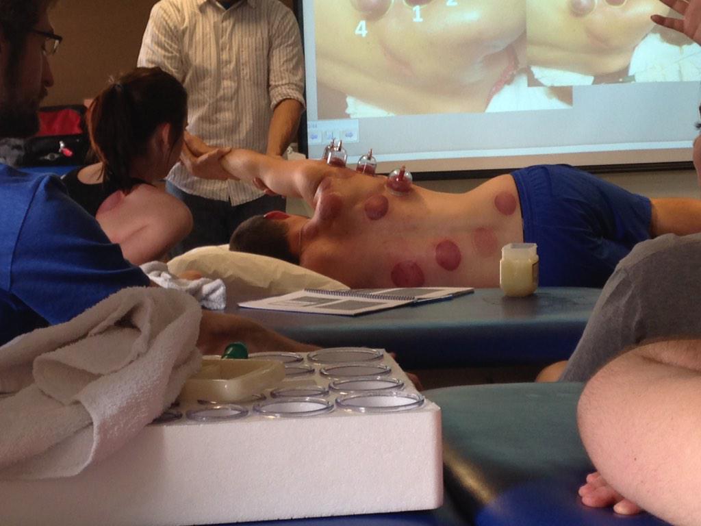 teamilliana's tweet photo. @ISUPTSR just had 4 of their clinicians at the course to learn myofascial decompression... Will it help your pain? http://t.co/oaRoXrJJCm