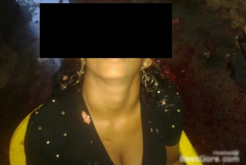 razenevasiq's tweet photo. 【超閲覧注意】
散弾銃で撃たれた女性の頭部が吹き飛ぶ・・・

想像を超えるヤバい画像です
→http://t.co/3GxavnmuZA

見ない方がいいかも http://t.co/rxHqAOf5qn