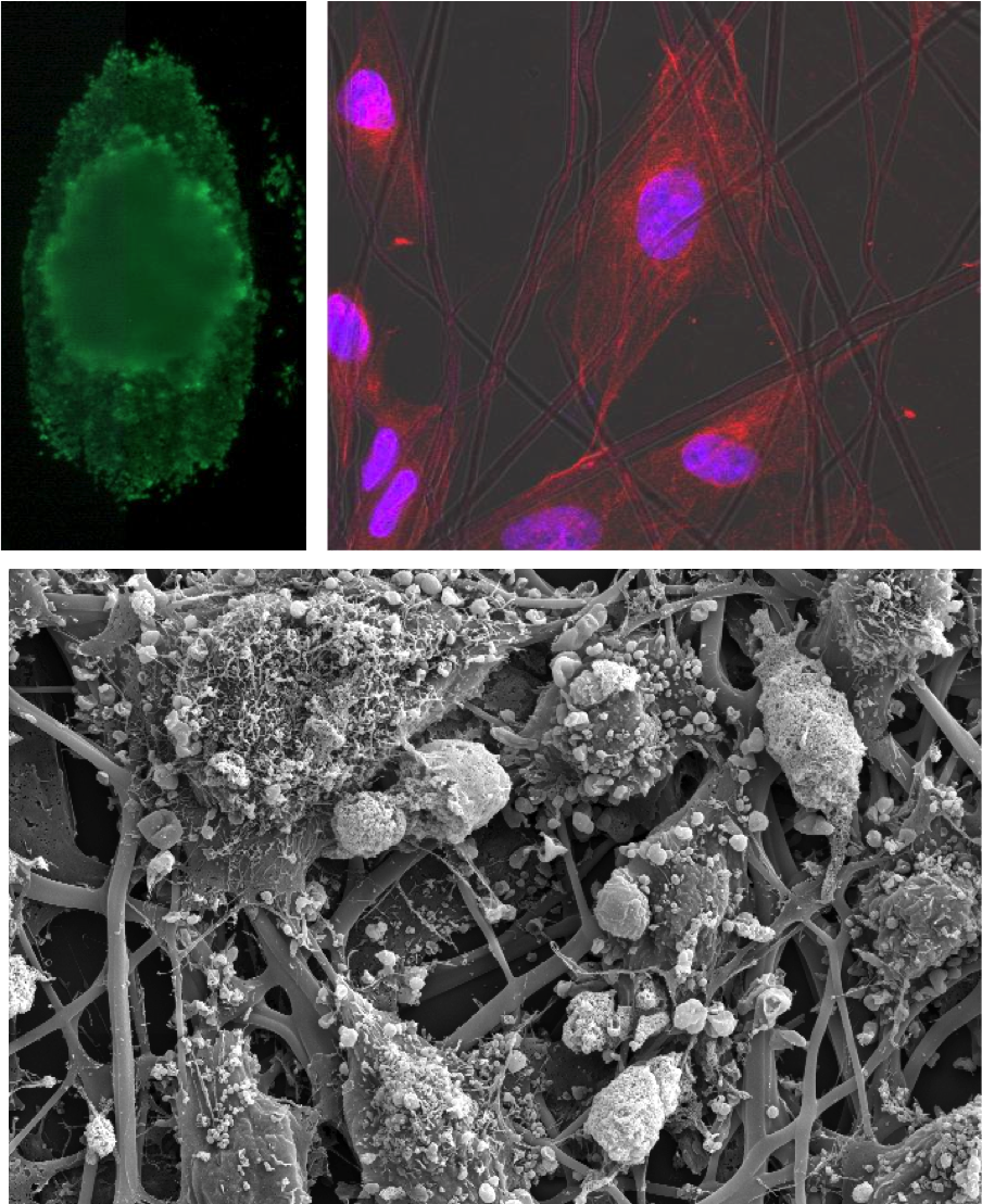 NanoSol's tweet photo. Honored to be a part of the fight against cancer #WorldCancerDay http://t.co/qwg0nvRF8m http://t.co/QhVdsVaZpH