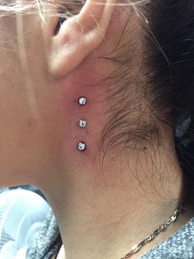 Un Dermato Peut Il Reboucher Un Piercing