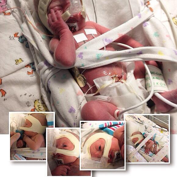 Pray4Jacoby's tweet photo. Jacoby was born Sept 4th he was soon after diagnosed w/ #WolfHirschhornSyndrome when they discovered heart defects http://t.co/jw2YEds5Ba