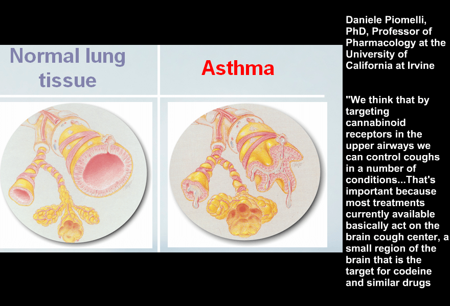 Cannabis

#Medical #Marijuana #cannabis #lungs #asthma  #health #medical #breath #medicine #medicalmarijuana