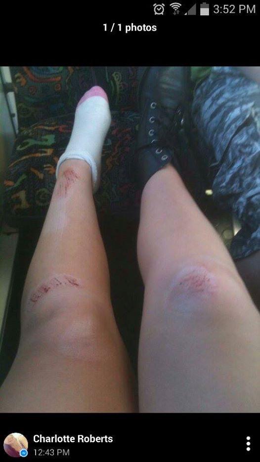 TheMusicCharlie's tweet photo. A great way to start my final year of school, by falling down my front steps on the way out to the bus I'm very sore. http://t.co/SBOHG3gzwa