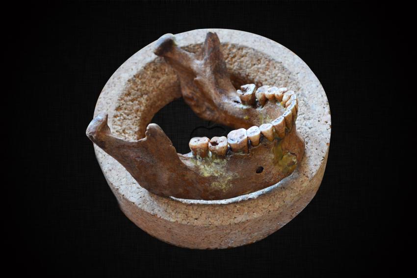 archaeologymag's tweet photo. Agriculture shaped the human jaw in complex ways, leading to dental overcrowding http://t.co/I6V3w4ZHQZ http://t.co/artNfzz0Wz